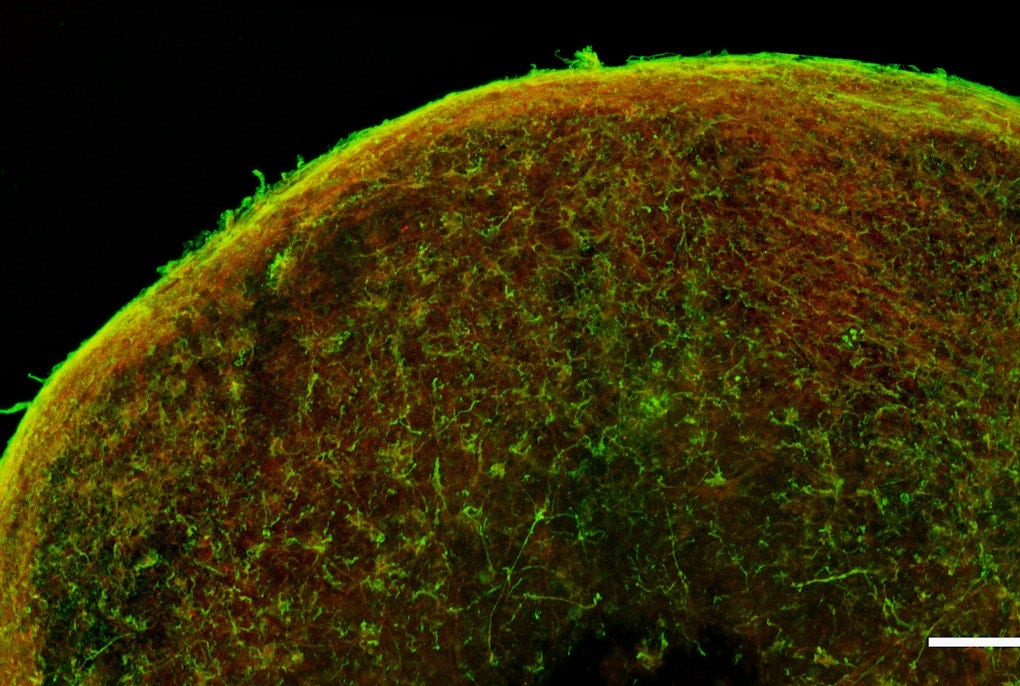 Modelli di cellule 3D per studiare meglio il Parkinson